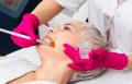 Chemical Skin Peels
