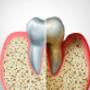 Gum Disease Treatment Melbourne