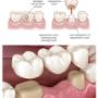 dentist-dulwich-hill-1