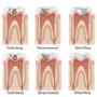 dentist-dulwich-hill-3
