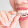 dentist-dulwich-hill-5 (1)