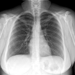 Outback Medical Imaging