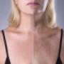 Skin Tightening