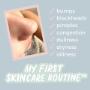 Blackheads-pre-teen