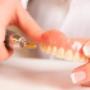 Denture Repairs