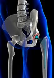 A.M. Orthopaedics