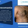 Gynecomastia Surgery