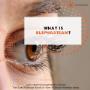 # 34