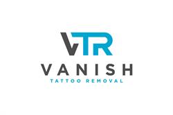 Vanish Tattoo Removal