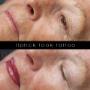 Lip Blush Cosmetic Tattoo