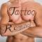Tattoo-Removal