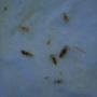 Adult and nymph stage head lice with hatched and unhatched eggs