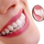 Teeth Whitening Bentleigh East