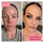 Before and after 1