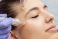 Dermapen Skin Needling ( Vampire Facial )