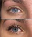 Eyelash Lift