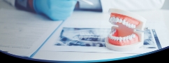 Dental Implants in Box Hill - Crystal Dental