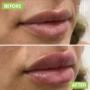 # 704