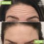 # 350