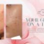 Larimedical Peel