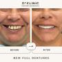 Sydney Complete Dentures