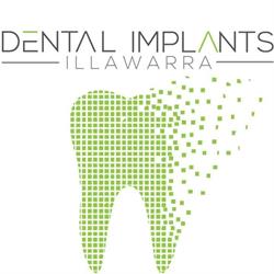 Dental Implants Illawarra