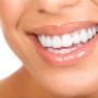 teeth whitening - no gap dentists - sydney