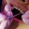 Metal-Braces