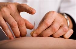 Apex Acupuncture and Remedial Massage
