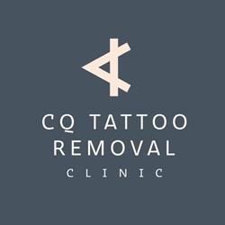 CQ Tattoo Removal Clinic - Tineeke Tucker