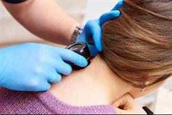 Skin Cancer Northcote