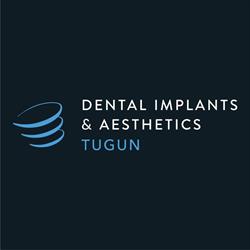 Dental Implants & Aesthetics Tugun
