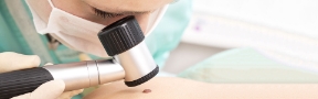 Mole Check Clinic in Narre Warren