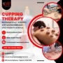Cupping Therapy