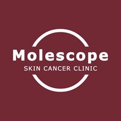 Molescope
